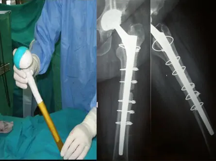 Traumatólogo especialista en cirugía ortopédica de rodilla Dr. Manuel Villanueva