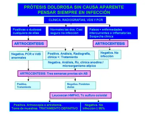 Revisión Prótesis Total Rodilla por el especialista en Prótesis de Rodilla Dr. Villanueva