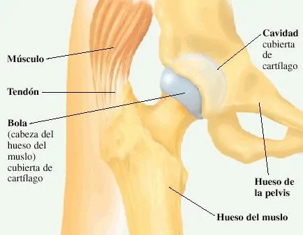  Dr. Manuel Villanueva Protesis Cadera y Rodilla. Educación pacientes con prótesis total de cadera