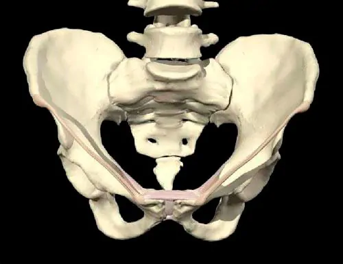 La infección tardía de prótesis de cadera es aquella que se produce o manifiesta tras un período relativamente largo tras haber realizado la cirugía de prótesis de cadera.
