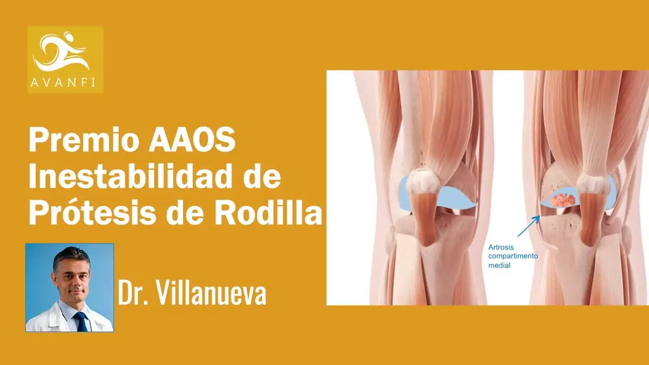 Doctor Villanueva, especialista en Inestabilidad de Prótesis de Rodilla