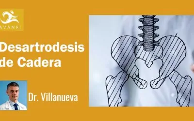 ¿Qué es una Desartrodesis de Cadera?