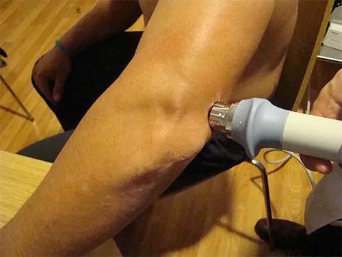 Lesión de Codo, lesiones del triceps por el especialista en Traumatología Dr. Manuel Villanueva