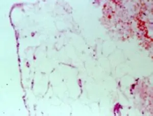 Capa única de células sinoviales revistiendo el tejido adiposo subsinovial