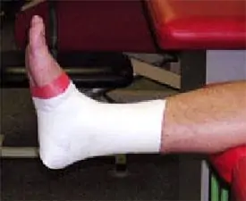 Lesiones de Tobillo y pie Esguince de tobillo por el especialista en traumatología y lesiones deportivas Dr. Manuel Villanueva